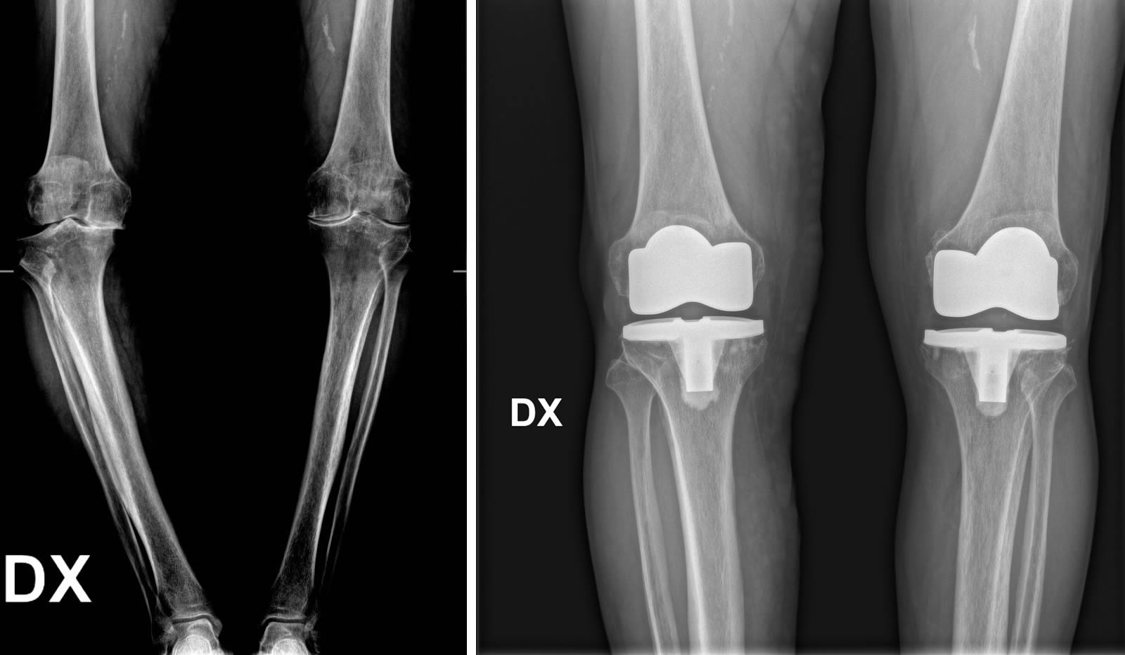 ForoPrePost1.jpg (95 KB)